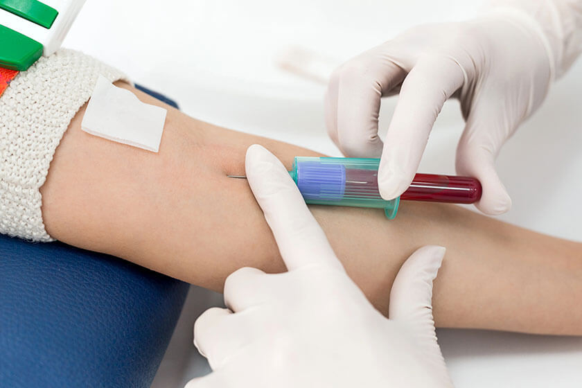 Blood test from vein, phlebotomy vs. medical assistant