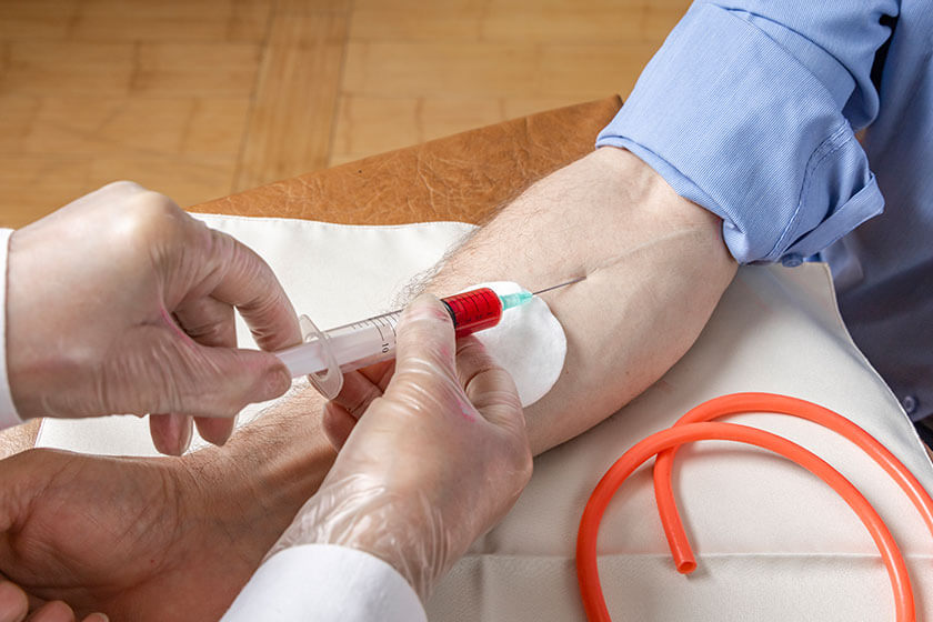 Hands of a nurse take blood from a male hand for analysis, phlebotomy procedure