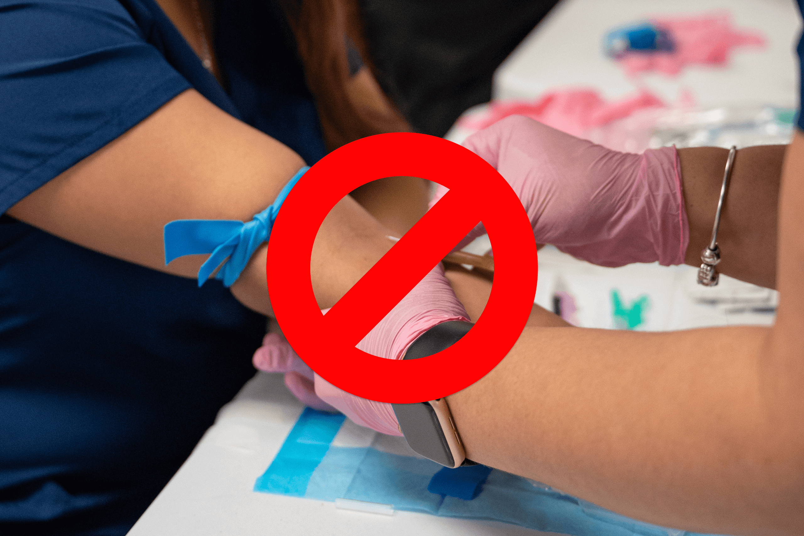 Flying Needle Technique